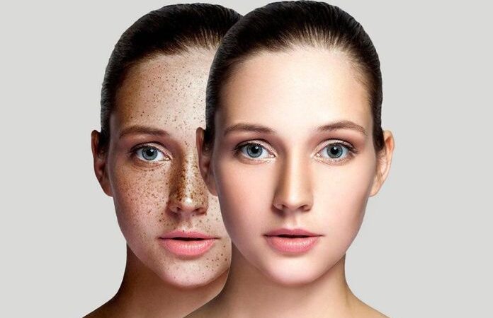 Wellhealthorganic.com : Remove Dark Spots On Face Tang – Lemon Juice