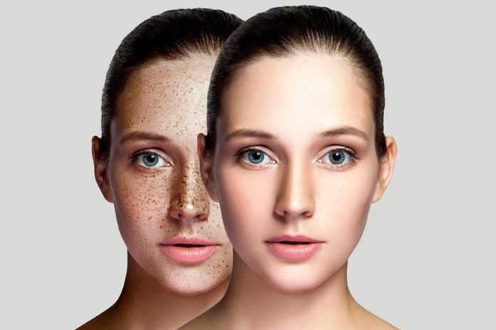 Wellhealthorganic.com : Remove Dark Spots On Face Tang – Lemon Juice